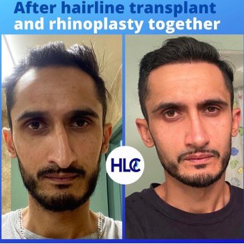 Hairline Clinic Instagram